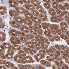 Anti-PSMB3 Antibody