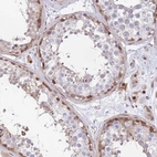 Anti-KIAA1211 Antibody
