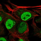 Immunofluorescent staining of human cell line SK-MEL-30 shows localization to nucleoplasm & the Golgi apparatus.