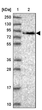 Lane 1: Marker [kDa] 250, 130, 95, 72, 55, 36, 28, 17, 10_br/_Lane 2: Human cell line RT-4