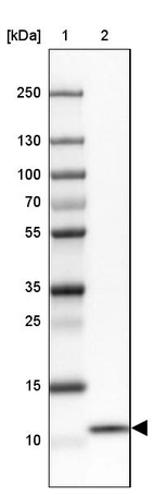 Lane 1: Marker [kDa] 250, 130, 100, 70, 55, 35, 25, 15, 10_br/_Lane 2: Human cell line MOLT-4