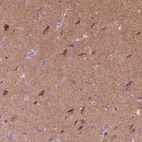 Immunohistochemical staining of human cerebral cortex shows high expression.