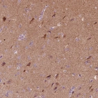 Immunohistochemical staining of human cerebral cortex shows high expression.