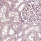 Immunohistochemical staining of human kidney shows low expression as expected.