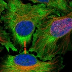 Immunofluorescent staining of human cell line HeLa shows localization to cytosol.