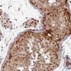 Anti-SIK3 Antibody