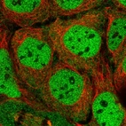 Immunofluorescent staining of human cell line CACO-2 shows localization to nucleoplasm.
