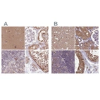 Anti-NAXE Antibody