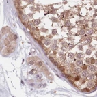 Immunohistochemical staining of human testis using Anti-NAXE antibody HPA048164.