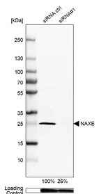 Western blot analysis in MCF-7 cells transfected with control siRNA, target specific siRNA probe #1, using Anti-NAXE antibody. Remaining relative intensity is presented. Loading control: Anti-GAPDH.