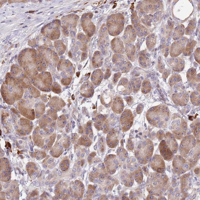 Anti-CCDC140 Antibody