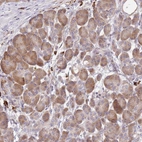Anti-CCDC140 Antibody