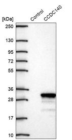 Western blot analysis in control (vector only transfected HEK293T lysate) and CCDC140 over-expression lysate (Co-expressed with a C-terminal myc-DDK tag (~3.1 kDa) in mammalian HEK293T cells, LY407174).