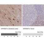 Anti-SPHKAP Antibody