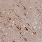 Immunohistochemical staining of human cerebral cortex shows high expression.