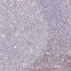 Immunohistochemical staining of human tonsil shows low expression as expected.