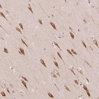 Anti-TBC1D2B Antibody
