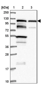 Lane 1: Marker [kDa] 250, 130, 95, 72, 55, 36, 28, 17, 10_br/_Lane 2: Human cell line RT-4_br/_Lane 3: Human cell line U-251MG sp