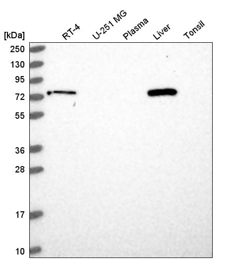 Anti-LCMT2 Antibody