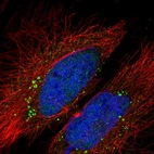 Immunofluorescent staining of human cell line HeLa shows localization to nucleoplasm & vesicles.