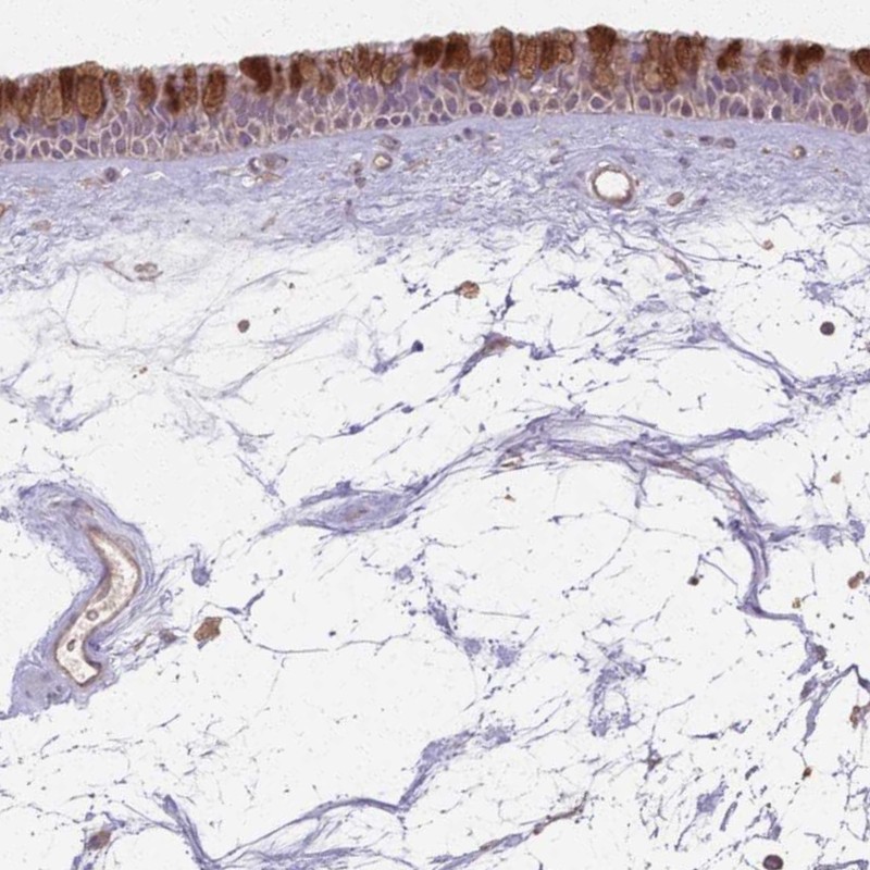 Anti-CCDC168 Antibody