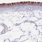 Anti-CCDC168 Antibody