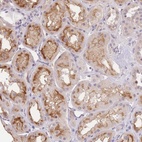 Anti-SLC35F2 Antibody