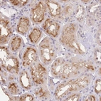Anti-SLC35F2 Antibody