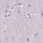 Immunohistochemical staining of human cerebral cortex using Anti-ACY3 antibody HPA048187.