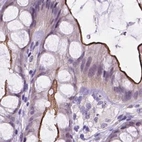 Immunohistochemical staining of human colon using Anti-ACY3 antibody HPA048187.