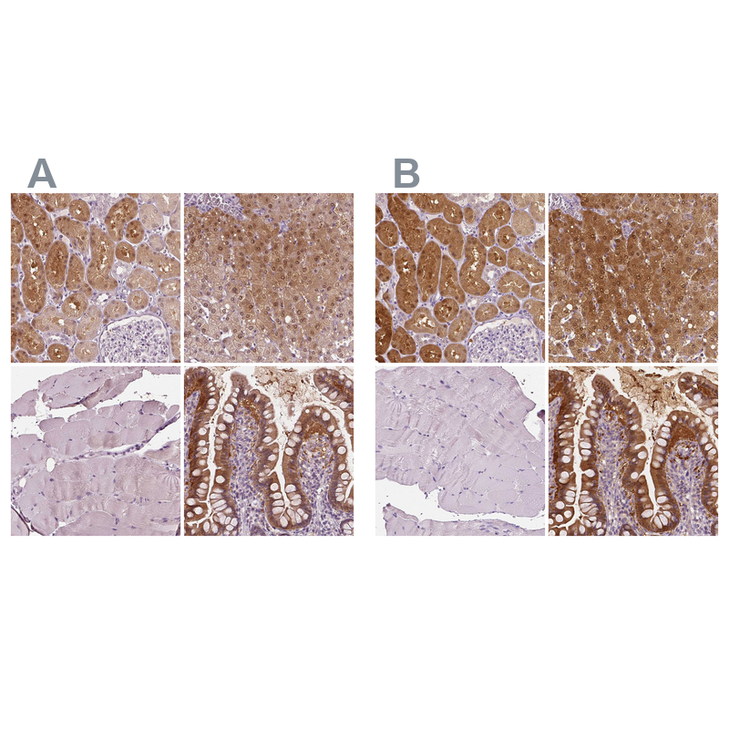 Anti-TKFC Antibody