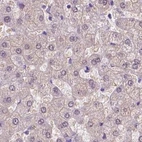 Immunohistochemical staining of human liver using Anti-ACY3 antibody HPA048187.