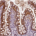 Immunohistochemical staining of human small intestine shows strong cytoplasmic positivity in glandular cells.
