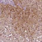 Immunohistochemical staining of human liver shows strong cytoplasmic positivity in hepatocytes.
