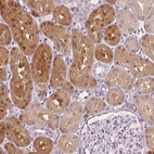 Immunohistochemical staining of human kidney shows strong cytoplasmic positivity in cells in tubules.