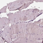 Immunohistochemical staining of human skeletal muscle shows no positivity in myocytes as expected.