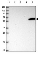 Lane 1: Marker [kDa] 250, 130, 95, 72, 55, 36, 28, 17, 10_br/_Lane 2: Human cell line RT-4_br/_Lane 3: Human cell line U-251 MG_br/_Lane 4: Human plasma_br/_Lane 5: Human Liver tissue