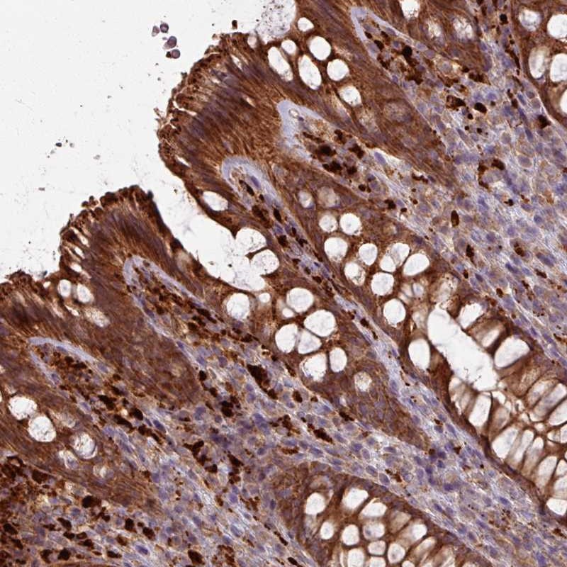 Anti-CCDC68 Antibody