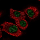 Anti-TSEN34 Antibody