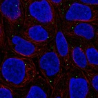 Anti-WDR72 Antibody