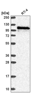 Western blot analysis in human cell line RT-4.