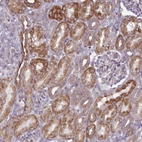 Anti-PAPD5 Antibody