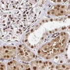 Immunohistochemical staining of human kidney using Anti-GLYR1 antibody HPA048226.