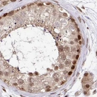 Immunohistochemical staining of human testis using Anti-GLYR1 antibody HPA048226.