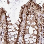 Immunohistochemical staining of human colon using Anti-GLYR1 antibody HPA048226.