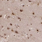 Immunohistochemical staining of human cerebral cortex using Anti-GLYR1 antibody HPA048226.