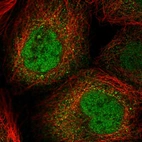 Immunofluorescent staining of human cell line A-431 shows localization to nucleoplasm & cytosol.