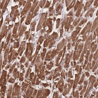 Anti-TRIM3 Antibody