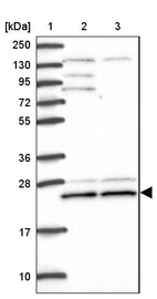 Lane 1: Marker [kDa] 250, 130, 95, 72, 55, 36, 28, 17, 10_br/_Lane 2: Human cell line RT-4_br/_Lane 3: Human cell line U-251MG sp