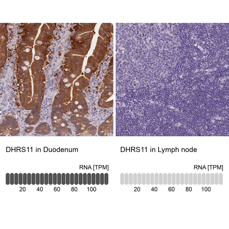 Anti-DHRS11 Antibody